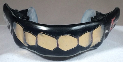 mouthguard