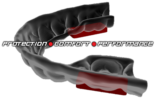 comfortable mouthguard