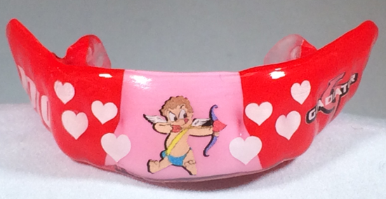 Custom Mouthguard