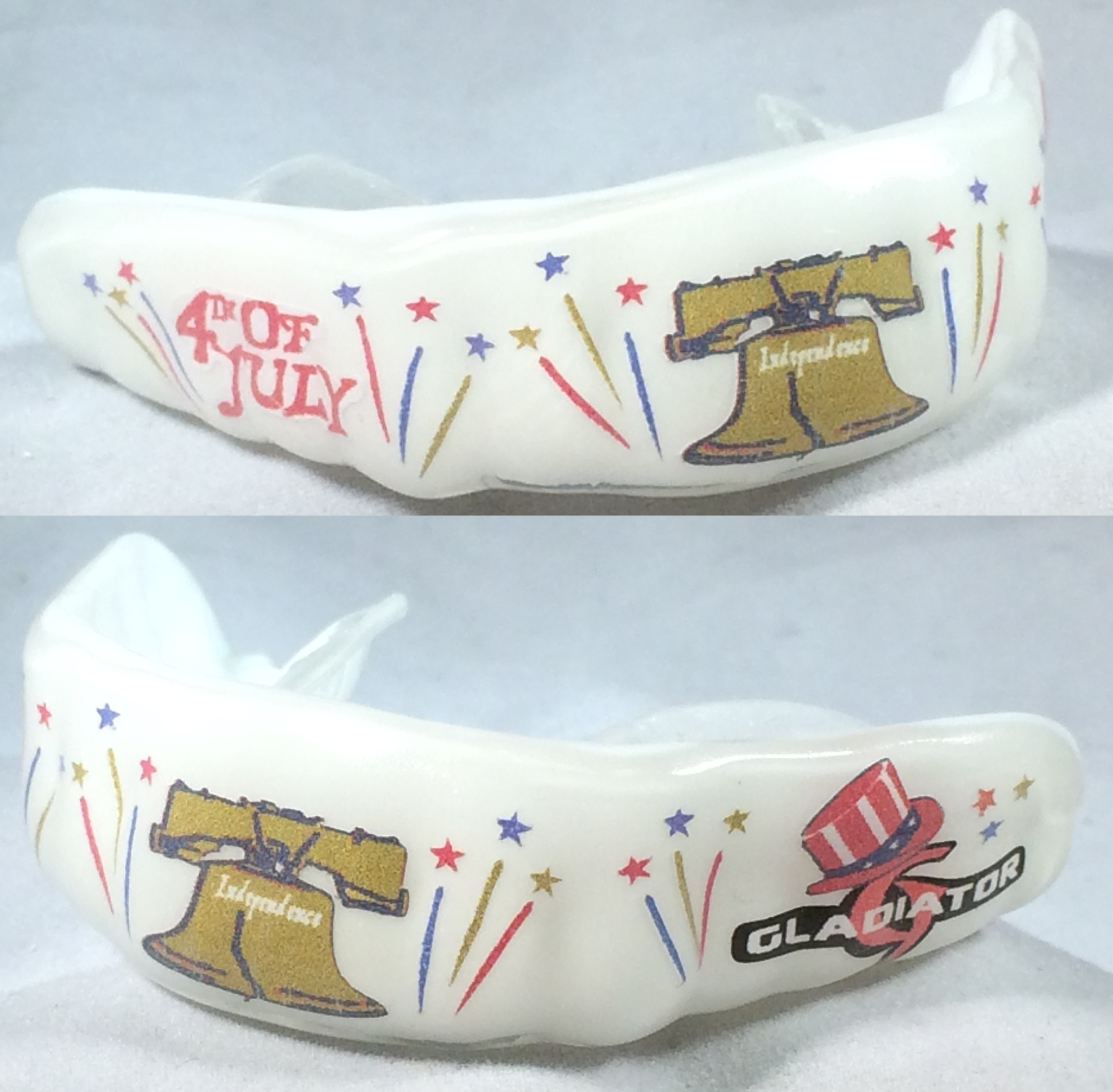 custom mouthguard