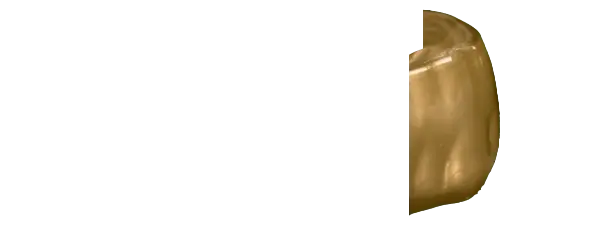 Metallic Gold Guard