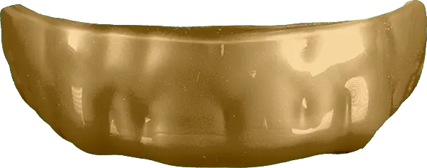 Metallic Gold Guard