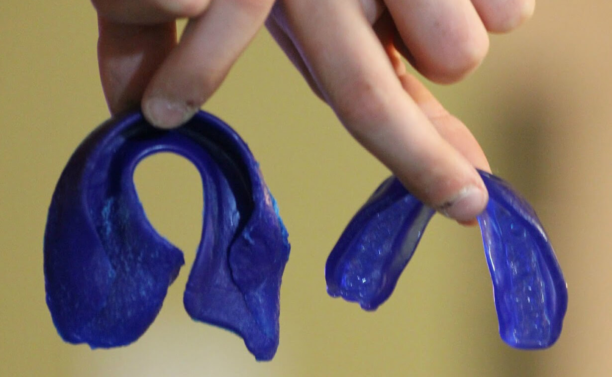 5 Tips To Make Sure Your Team’s Mouthguards Last