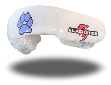 Kieran McArdle Waterdogs Mouthguard