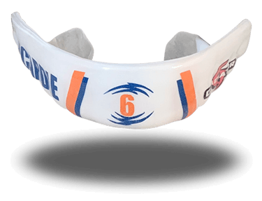 McArdle Riptide Custom Mouthguard