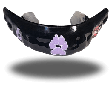 McArdle Custom Mouthguard