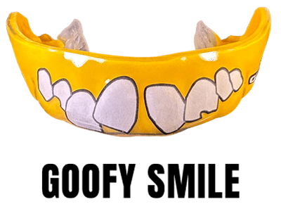 crooked teeth mouthguard